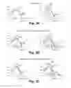 Fig. 04 - Method to reduce etch variation using ion implantation