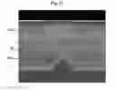 Fig. 18 - Light emitting diode having a plurality of light emitting units