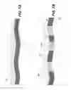 Fig. 08 - Ultraviolet reflective rough adhesive contact