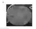 Fig. 03 - Lithium secondary battery