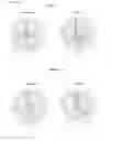 Fig. 11 - Antenna systems with proximity coupled annular rectangular patches