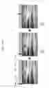 Fig. 25 - Image encoding apparatus and image decoding apparatus and method of operating the same