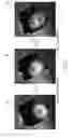 Fig. 04 - Determining transmit power limits using a combined specific absorption measurement for multiple transmitters