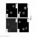 Fig. 08 - Platelet additive solution having a β-galactosidase inhibitor