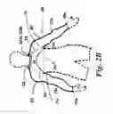 Fig. 05 - Sleeved partial undergarment and garment system