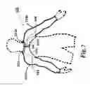 Fig. 16 - Sleeved partial undergarment and garment system