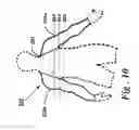 Fig. 19 - Sleeved partial undergarment and garment system