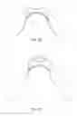 Fig. 28 - Sleeved partial undergarment and garment system