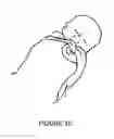 Fig. 11 - POCKET SWADDLE