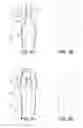 Fig. 06 - LIFTING RESILIENT GARMENT AND METHOD FOR ADJUSTING THE SAME