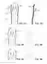 Fig. 07 - LIFTING RESILIENT GARMENT AND METHOD FOR ADJUSTING THE SAME