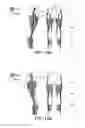 Fig. 14 - LIFTING RESILIENT GARMENT AND METHOD FOR ADJUSTING THE SAME