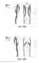 Fig. 17 - LIFTING RESILIENT GARMENT AND METHOD FOR ADJUSTING THE SAME