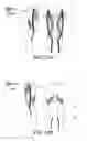 Fig. 20 - LIFTING RESILIENT GARMENT AND METHOD FOR ADJUSTING THE SAME