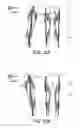 Fig. 21 - LIFTING RESILIENT GARMENT AND METHOD FOR ADJUSTING THE SAME