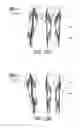 Fig. 22 - LIFTING RESILIENT GARMENT AND METHOD FOR ADJUSTING THE SAME