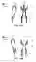 Fig. 23 - LIFTING RESILIENT GARMENT AND METHOD FOR ADJUSTING THE SAME