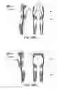 Fig. 25 - LIFTING RESILIENT GARMENT AND METHOD FOR ADJUSTING THE SAME