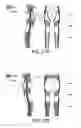 Fig. 26 - LIFTING RESILIENT GARMENT AND METHOD FOR ADJUSTING THE SAME