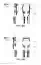 Fig. 28 - LIFTING RESILIENT GARMENT AND METHOD FOR ADJUSTING THE SAME