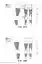 Fig. 29 - LIFTING RESILIENT GARMENT AND METHOD FOR ADJUSTING THE SAME
