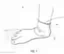 Fig. 02 - FOOT GLOVE