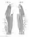 Fig. 05 - Glove for conforming to hands of various sizes