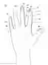 Fig. 01 - METHOD OF MAKING POLYMERIC GLOVES HAVING EMBEDDED SURGICAL SUPPORT SYSTEMS AND DISCRETE ELEMENTS