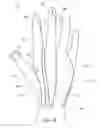Fig. 06 - METHOD OF MAKING POLYMERIC GLOVES HAVING EMBEDDED SURGICAL SUPPORT SYSTEMS AND DISCRETE ELEMENTS