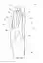 Fig. 08 - METHOD OF MAKING POLYMERIC GLOVES HAVING EMBEDDED SURGICAL SUPPORT SYSTEMS AND DISCRETE ELEMENTS