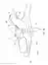Fig. 11 - METHOD OF MAKING POLYMERIC GLOVES HAVING EMBEDDED SURGICAL SUPPORT SYSTEMS AND DISCRETE ELEMENTS
