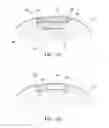 Fig. 12 - METHOD OF MAKING POLYMERIC GLOVES HAVING EMBEDDED SURGICAL SUPPORT SYSTEMS AND DISCRETE ELEMENTS