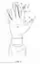 Fig. 15 - METHOD OF MAKING POLYMERIC GLOVES HAVING EMBEDDED SURGICAL SUPPORT SYSTEMS AND DISCRETE ELEMENTS