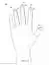 Fig. 19 - METHOD OF MAKING POLYMERIC GLOVES HAVING EMBEDDED SURGICAL SUPPORT SYSTEMS AND DISCRETE ELEMENTS