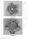 Fig. 11 - VARIABLE ORNAMENT ASSEMBLY