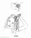 Fig. 07 - Hair care device
