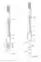 Fig. 05 - Force-sensing toothbrush