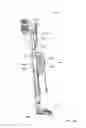 Fig. 105 - Surface cleaning apparatus
