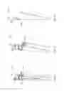 Fig. 115 - Surface cleaning apparatus