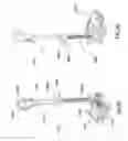 Fig. 92 - All in the head surface cleaning apparatus