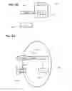 Fig. 05 - ENDOSCOPE WITH SHARED WORKING CHANNEL