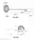 Fig. 34 - ENDOSCOPE WITH SHARED WORKING CHANNEL