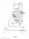 Fig. 02 - INTRODUCTION DEVICE