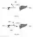 Fig. 07 - Device and method for assisting laparoscopic surgery—rule based approach