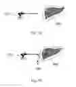 Fig. 08 - Device and method for assisting laparoscopic surgery—rule based approach