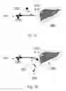 Fig. 09 - Device and method for assisting laparoscopic surgery—rule based approach
