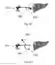 Fig. 11 - Device and method for assisting laparoscopic surgery—rule based approach