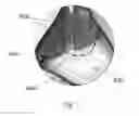 Fig. 12 - Device and method for assisting laparoscopic surgery—rule based approach