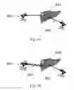 Fig. 14 - Device and method for assisting laparoscopic surgery—rule based approach