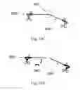 Fig. 16 - Device and method for assisting laparoscopic surgery—rule based approach